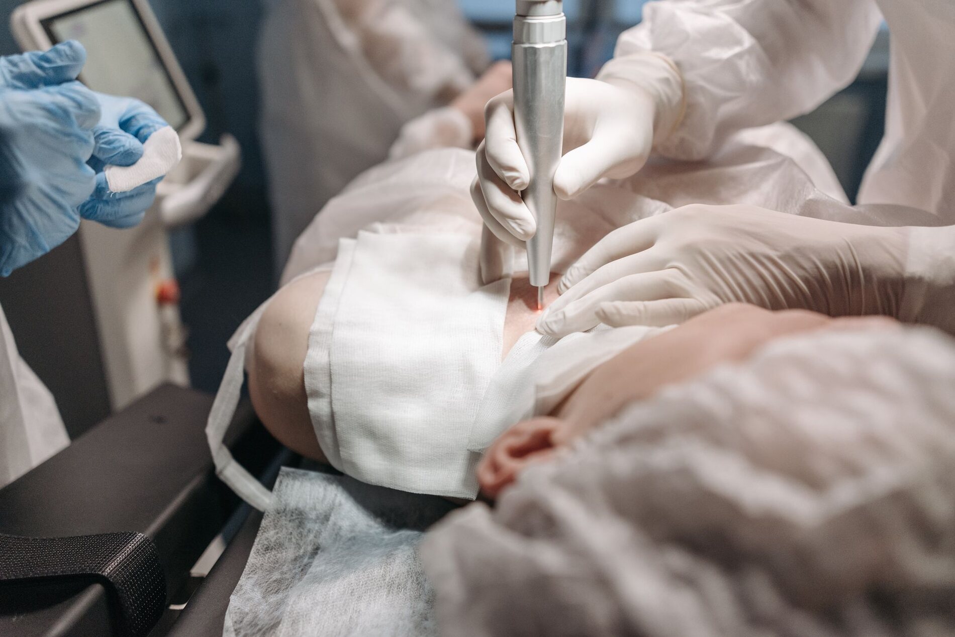 Huidanalyse & microneedling